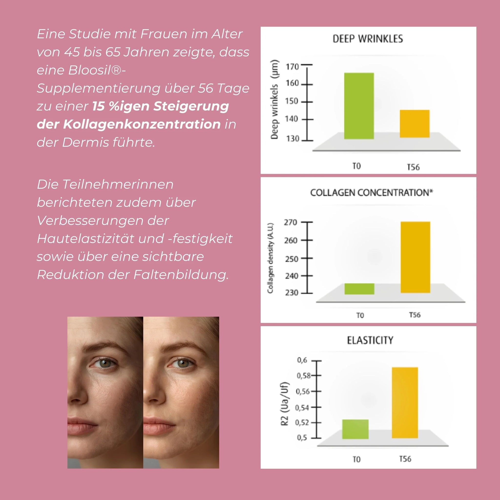 Silizium (Bloosil®)